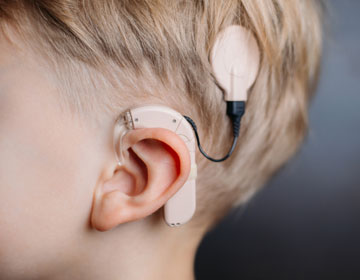 Cochlear Implants