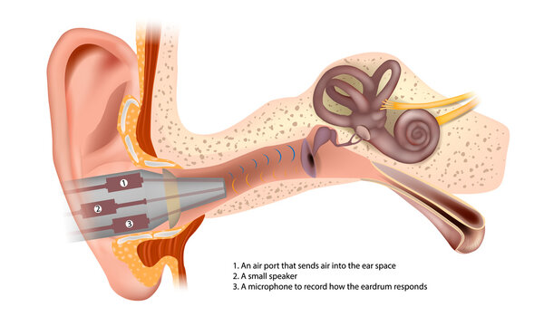 PTA Impedance Audiometry Services in Ahmedabad